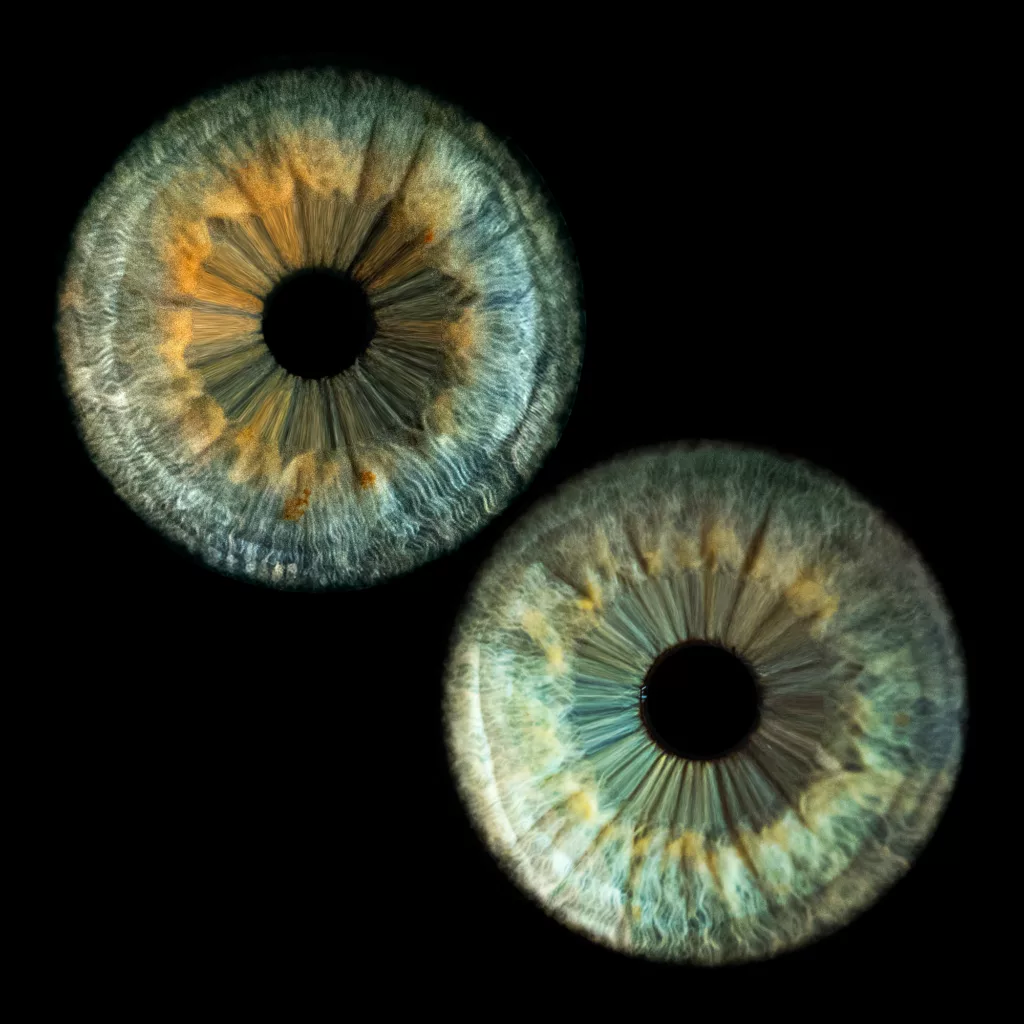2 iris